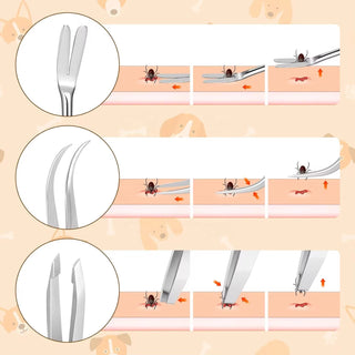 3 Pack Tick Remover Tool kit Stainless Steel Tick Remover Tweezers
